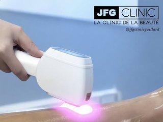 L'épilation définitive au laser